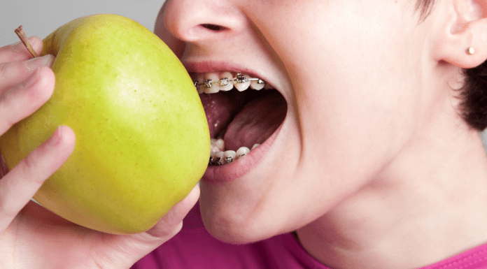 mouth with braces eating apple