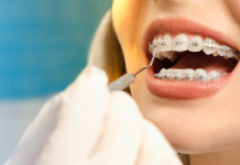 dentist checking braces